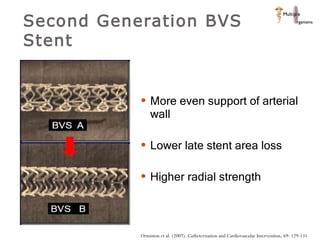 Second Generation BVS Stent More even support of arterial wall Lower late stent area loss Higher radial strength Ormiston et al. (2007). Catheterization and Cardiovascular Intervention, 69: 129-131 