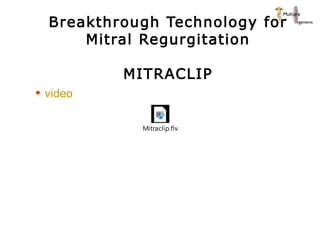 Breakthrough Technology for Mitral Regurgitation MITRACLIP video 