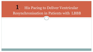 1. His Pacing to Deliver Ventricular
Resynchronisation in Patients with LBBB
 
