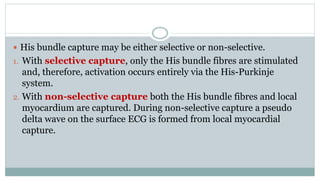  His bundle capture may be either selective or non-selective.
1. With selective capture, only the His bundle fibres are stimulated
and, therefore, activation occurs entirely via the His-Purkinje
system.
2. With non-selective capture both the His bundle fibres and local
myocardium are captured. During non-selective capture a pseudo
delta wave on the surface ECG is formed from local myocardial
capture.
 