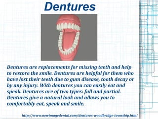 Dentures
Dentures are replacements for missing teeth and help
to restore the smile. Dentures are helpful for them who
have lost their teeth due to gum disease, tooth decay or
by any injury. With dentures you can easily eat and
speak. Dentures are of two types: full and partial.
Dentures give a natural look and allows you to
comfortably eat, speak and smile.
http://www.newimagedental.com/dentures-woodbridge-township.html
 