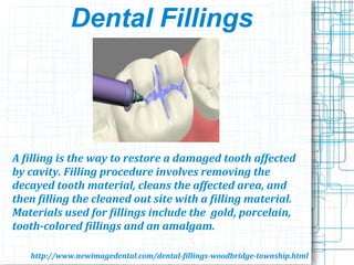 Dental Fillings
A filling is the way to restore a damaged tooth affected
by cavity. Filling procedure involves removing the
decayed tooth material, cleans the affected area, and
then filling the cleaned out site with a filling material.
Materials used for fillings include the gold, porcelain,
tooth-colored fillings and an amalgam.
http://www.newimagedental.com/dental-fillings-woodbridge-township.html
 