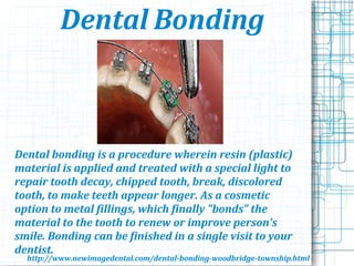 Dental Bonding
Dental bonding is a procedure wherein resin (plastic)
material is applied and treated with a special light to
repair tooth decay, chipped tooth, break, discolored
tooth, to make teeth appear longer. As a cosmetic
option to metal fillings, which finally "bonds" the
material to the tooth to renew or improve person's
smile. Bonding can be finished in a single visit to your
dentist.
http://www.newimagedental.com/dental-bonding-woodbridge-township.html
 