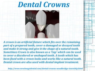 Dental Crowns
A crown is an artificial fixture which fits over the remaining
part of a prepared tooth, cover a damaged or decayed tooth
and make it strong and give it the shape of a natural tooth.
Sometimes Crown is also known as a 'Cap' which can be used
to cover a discolored or unshaped tooth. A tooth which has
been fixed with a crown looks and works like a natural tooth.
Dental crown are also used with dental implant treatment.
http://www.newimagedental.com/dental-crowns-woodbridge-township.html
 