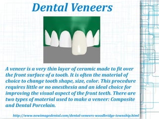 Dental Veneers
A veneer is a very thin layer of ceramic made to fit over
the front surface of a tooth. It is often the material of
choice to change tooth shape, size, color. This procedure
requires little or no anesthesia and an ideal choice for
improving the visual aspect of the front teeth. There are
two types of material used to make a veneer: Composite
and Dental Porcelain.
http://www.newimagedental.com/dental-veneers-woodbridge-township.html
 