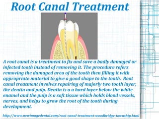 Root Canal Treatment
A root canal is a treatment to fix and save a badly damaged or
infected tooth instead of removing it. The procedure refers
removing the damaged area of the tooth then filling it with
appropriate material to give a good shape to the tooth. Root
canal treatment involves repairing of majorly two tooth layer,
the dentin and pulp. Dentin is a a hard layer below the white
enamel and the pulp is a soft tissue which holds blood vessels,
nerves, and helps to grow the root of the tooth during
development.
http://www.newimagedental.com/root-canal-treatment-woodbridge-township.html
 