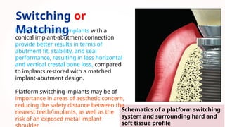NEW dental implant design [Autosaved].pptx