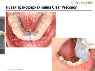 12
Новая трансферная каппа Clear Precision
© 3M 2009. All Rights Reserved.
 