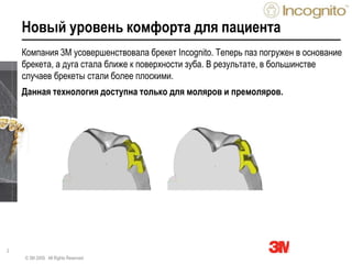 2
Новый уровень комфорта для пациента
© 3M 2009. All Rights Reserved.
Компания 3М усовершенствовала брекет Incognito. Теперь паз погружен в основание
брекета, а дуга стала ближе к поверхности зуба. В результате, в большинстве
случаев брекеты стали более плоскими.
Данная технология доступна только для моляров и премоляров.
 