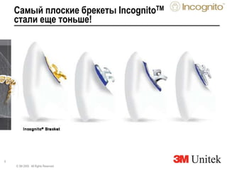 6
Самый плоские брекеты IncognitoTM
стали еще тоньше!
© 3M 2009. All Rights Reserved.
 
