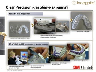 8
Clear Precision или обычная каппа?
© 2010 3M. All Rights Reserved.
Брекеты помещаются в каппу в положение,
определенное на компьютере
Позиционирование на основе
данных с монитора
Ручное позиционирование
на гипсовой модели
Формирование каппы поверх
гипсовой модели
Каппа готова к фиксации
Каппа Clear Precision
Обычная каппа (на примере: 2-х фазный силикон)
Каппа готова к фиксации
Изготавливается цифровым методом
 