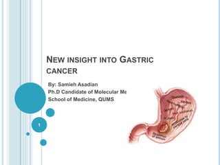 NEW INSIGHT INTO GASTRIC
CANCER
By: Samieh Asadian
Ph.D Candidate of Molecular Medicine
School of Medicine, QUMS
1
 