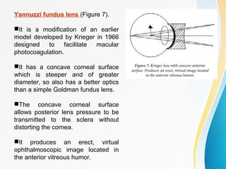 Yannuzzi fundus lens (Figure 7).
It is a modification of an earlier
model developed by Krieger in 1966
designed to facilitate macular
photocoagulation.
It has a concave corneal surface
which is steeper and of greater
diameter, so also has a better optics
than a simple Goldman fundus lens.
The concave corneal surface
allows posterior lens pressure to be
transmitted to the sclera without
distorting the cornea.
It produces an erect, virtual
ophthalmoscopic image located in
the anterior vitreous humor.
 