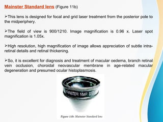 Mainster Standard lens (Figure 11b)
This lens is designed for focal and grid laser treatment from the posterior pole to
the midperiphery.
The field of view is 900/1210. Image magnification is 0.96 x. Laser spot
magnification is 1.05x.
High resolution, high magnification of image allows appreciation of subtle intra-
retinal details and retinal thickening.
So, it is excellent for diagnosis and treatment of macular oedema, branch retinal
vein occlusion, choroidal neovascular membrane in age-related macular
degeneration and presumed ocular histoplasmosis.
 