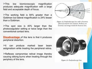 This low biomicroscopic magnification
produces adequate magnification with a large
field and acceptable depth of focus.
The working field is 84% greater than a
Goldman but lateral magnification is 24% lesser
than a Goldman.
The spot size is 40% larger than the
photocoagulator setting or twice large than the
conventional contact lens.
Disadvantage of this lens is that it produces
peripheral distortion.
It can produce marked laser beam
astigmatism while treating the peripheral retina.
Reflexes compromise retinal image thereby
causing oblong burns when treating through the
periphery of the lens.
 