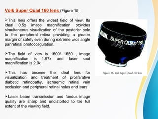 Volk Super Quad 160 lens (Figure 15)
This lens offers the widest field of view. Its
ideal 0.5x image magnification provides
simultaneous visualization of the posterior pole
to the peripheral retina providing a greater
margin of safety even during extreme wide angle
panretinal photocoagulation.
The field of view is 1600/ 1650 , image
magnification is 1.97x and laser spot
magnification is 2.0x.
This has become the ideal lens for
visualization and treatment of proliferative
diabetic retinopathy, ischaemic retinal vein
occlusion and peripheral retinal holes and tears.
Laser beam transmission and fundus image
quality are sharp and undistorted to the full
extent of the viewing field.
 