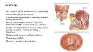 Pathology:
• BPH involves median and lateral lobes or one of them
• Median lobe enlarges into bladder
• Lateral lobe enlargement causes narrowing of urethra
causing obstruction
• Initially there is trabeculations and sacculation
formation in bladder and later diverticula formation
• Enlarged prostate compresses prostatic venous plexus
causing congestion , vesical piles leading to
haematuria
• Backpressure hydroureter and hydronephrosis
• Chronic pyelonephritis
• Obstructive uropathy with renal failure
 
