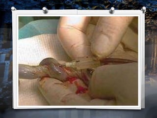 New medical breakthroughs