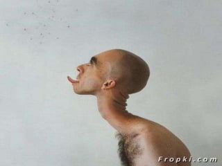 Human Deformities Pictures