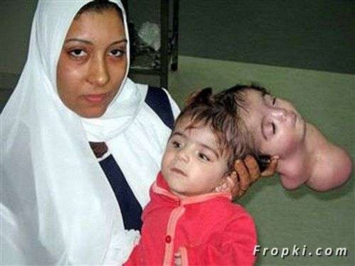 real human deformities