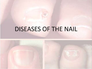 DISEASES OF THE NAIL
 