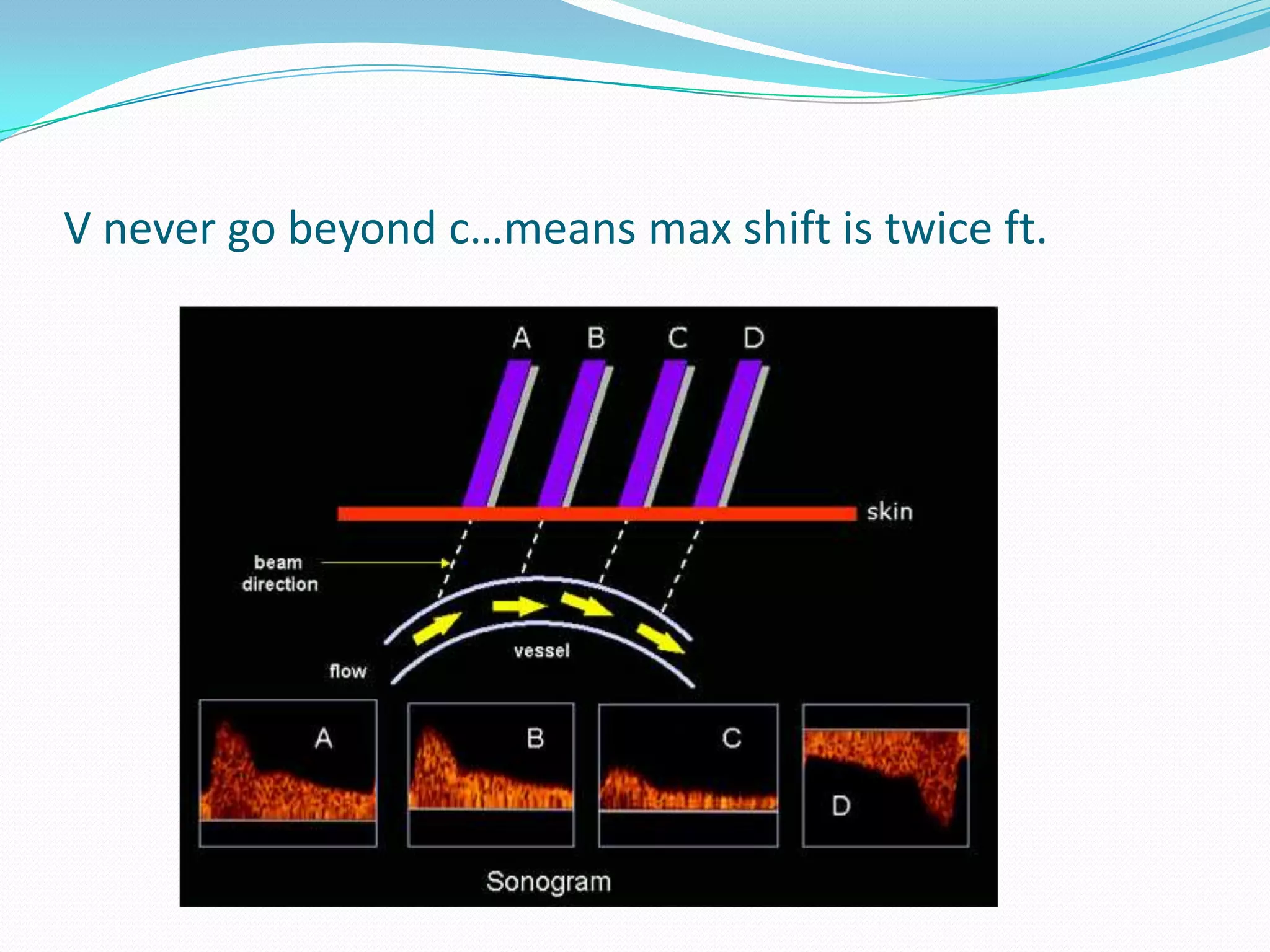 V never go beyond c…means max shift is twice ft.
 