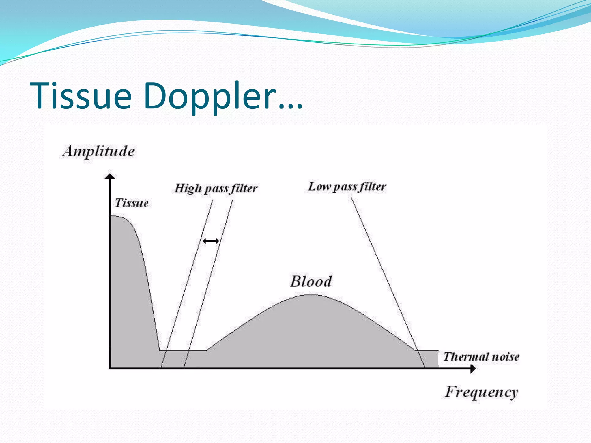 Tissue Doppler…
 