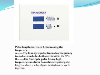 Pulse length shortened by increasing the
frequency.
A ........The four-cycle pulse from a low-frequency
transducer includes both objects within the SPL.
B .........The four-cycle pulse from a high-
frequency transducer has a shorter spatial pulse
length and can resolve objects located more closely
together.
 