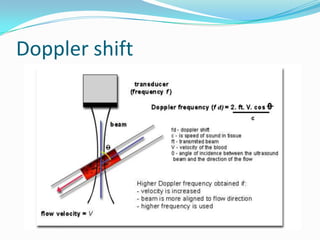 Doppler shift
 