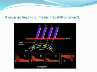 V never go beyond c…means max shift is twice ft.
 