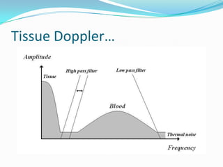 Tissue Doppler…
 
