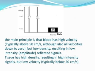 the main principle is that blood has high velocity
(Typically above 50 cm/s, although also all velocities
down to zero), but low density, resulting in low
intensity (amplitude) reflected signals.
Tissue has high density, resulting in high intensity
signals, but low velocity (typically below 20 cm/s).
 