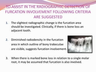 RADIOGRAPHIC AIDS IN THE DIAGNOSIS OF PERIODONTAL DISEASE | PPTX