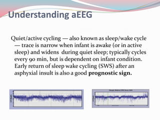 Understanding aEEG
Quiet/active cycling — also known as sleep/wake cycle
— trace is narrow when infant is awake (or in active
sleep) and widens during quiet sleep; typically cycles
every 90 min, but is dependent on infant condition.
Early return of sleep wake cycling (SWS) after an
asphyxial insult is also a good prognostic sign.

 