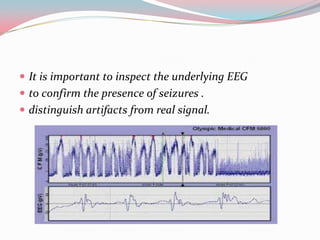  It is important to inspect the underlying EEG
 to confirm the presence of seizures .
 distinguish artifacts from real signal.

 