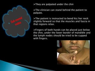 They are palpated under the chin
The clinician can stand behind the patient to
palpate.
The patient is instructed to bend his/her neck
slightly forward so that the muscles and fascia in
that regions relax.
Fingers of both hands can be placed just below
the chin, under the lower border of mandible and
the lymph nodes should be tried to be cupped
with fingers.
 