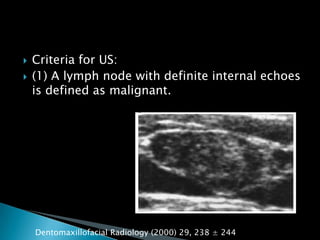  Criteria for US:
 (1) A lymph node with definite internal echoes
is defined as malignant.
Dentomaxillofacial Radiology (2000) 29, 238 ± 244
 