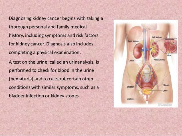 Kidney Cancer (renal cancer)