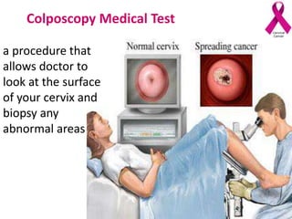Colposcopy Medical Test
a procedure that
allows doctor to
look at the surface
of your cervix and
biopsy any
abnormal areas
 