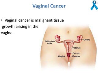 Vaginal Cancer
• Vaginal cancer is malignant tissue
growth arising in the
vagina.
 