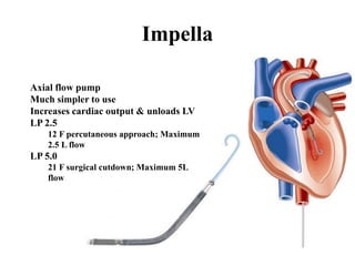 Impella
Axial flow pump
Much simpler to use
Increases cardiac output & unloads LV
LP 2.5
12 F percutaneous approach; Maximum
2.5 L flow
LP 5.0
21 F surgical cutdown; Maximum 5L
flow
 