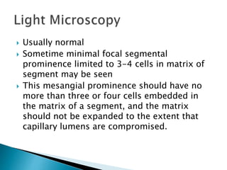  Usually normal
 Sometime minimal focal segmental
prominence limited to 3-4 cells in matrix of
segment may be seen
 This mesangial prominence should have no
more than three or four cells embedded in
the matrix of a segment, and the matrix
should not be expanded to the extent that
capillary lumens are compromised.
 