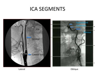 ARTERIAL AND VENOUS SUPPLY OF BRAIN | PPTX