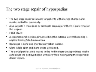 Circumcoronal Incision HYPOSPADIAS | PPTX