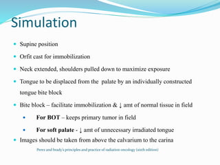 Simulation
 Supine position
 Orfit cast for immobilization
 Neck extended, shoulders pulled down to maximize exposure
 Tongue to be displaced from the palate by an individually constructed
tongue bite block
 Bite block – facilitate immobilization & ↓ amt of normal tissue in field
 For BOT – keeps primary tumor in field
 For soft palate - ↓ amt of unnecessary irradiated tongue
 Images should be taken from above the calvarium to the carina
Perez and brady’s principles and practice of radiation oncology (sixth edition)
 