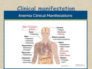 Clinical manifestation
 