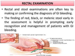 RECTAL EXAMINATION
• Rectal and stool examinations are often key to
making or confirming the diagnosis of GI bleeding.
• The finding of red, black, or melenic stool early in
the assessment is helpful in prompting early
recognition and management of patients with GI
bleeding.
 