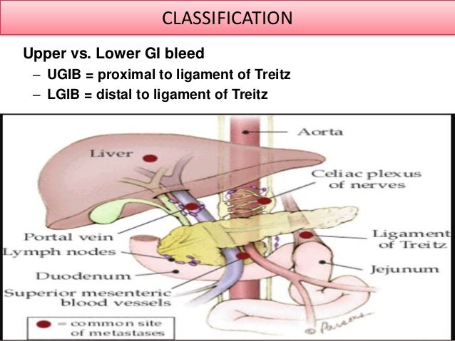 gastrointestinal bleeding ( GI Bleed)