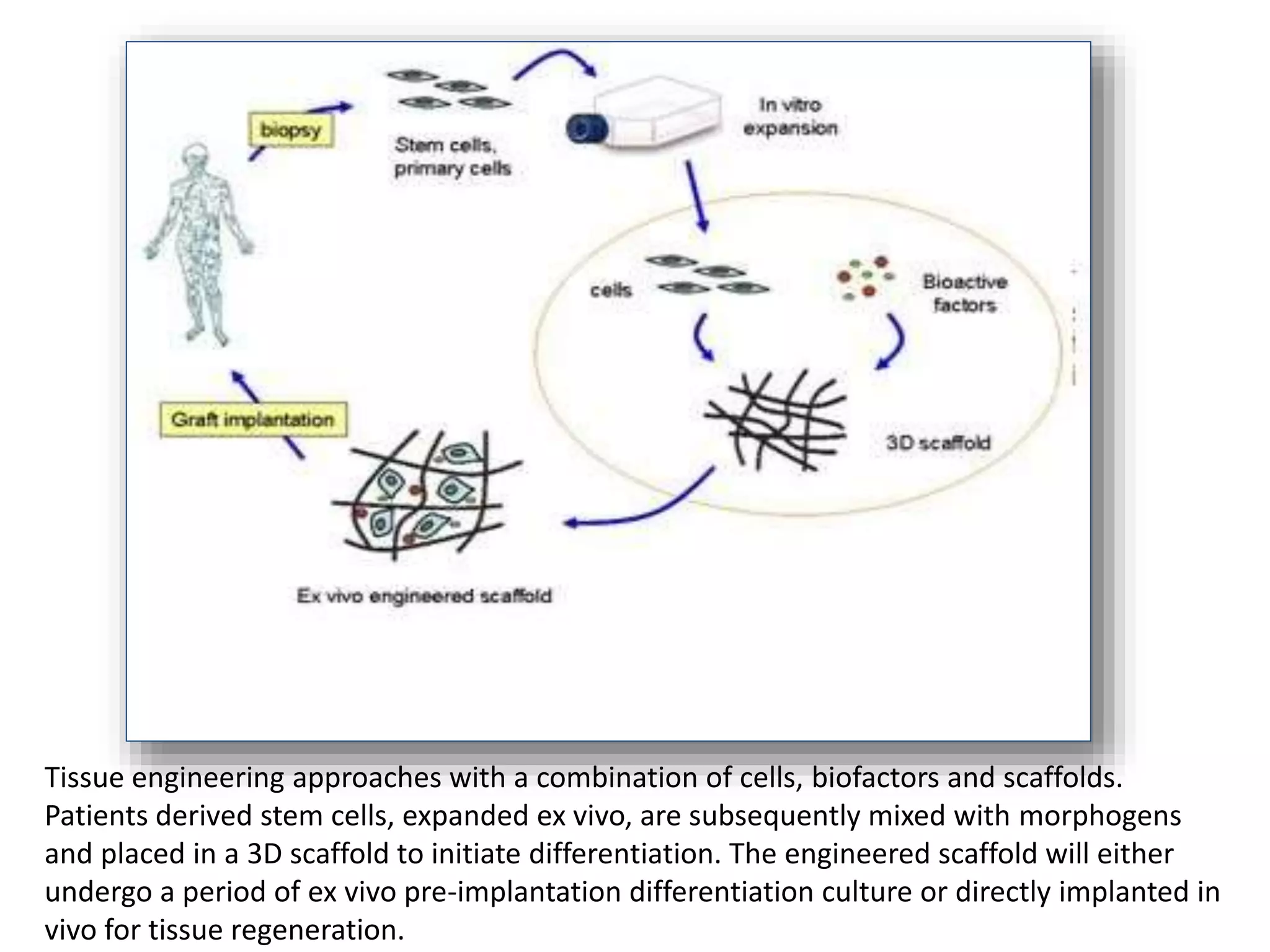 Tissue engineering approaches with a combination of cells, biofactors and scaffolds.
Patients derived stem cells, expanded ex vivo, are subsequently mixed with morphogens
and placed in a 3D scaffold to initiate differentiation. The engineered scaffold will either
undergo a period of ex vivo pre-implantation differentiation culture or directly implanted in
vivo for tissue regeneration.
 