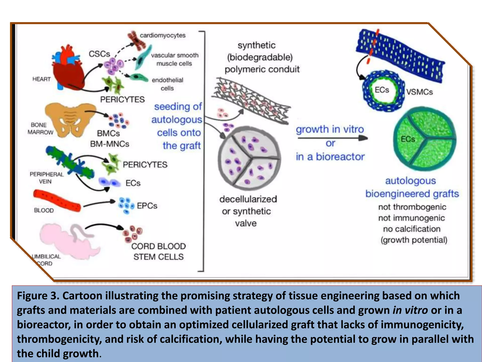 Figure 3. Cartoon illustrating the promising strategy of tissue engineering based on which
grafts and materials are combined with patient autologous cells and grown in vitro or in a
bioreactor, in order to obtain an optimized cellularized graft that lacks of immunogenicity,
thrombogenicity, and risk of calcification, while having the potential to grow in parallel with
the child growth.
 